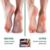 Miconazole Nitrate 2% Antifungal Cream