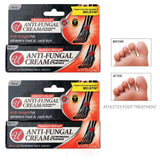 Miconazole Nitrate 2% Antifungal Cream