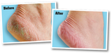 Heel Cream with Activate Foot Repair