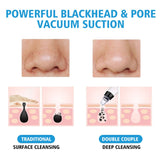Blackhead Remover Face Deep Cleaner Pore Acne Pimple Removal