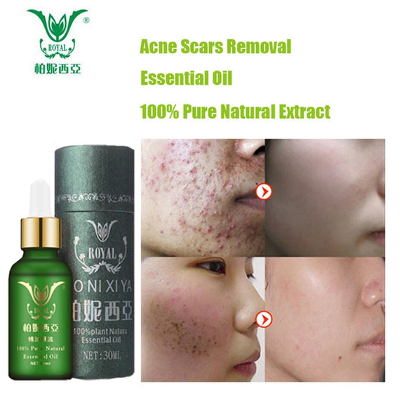 Face Care Essential Oil Acne Scar Spots Removal Skin Care