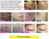 Face Care Essential Oil Acne Scar Spots Removal Skin Care